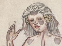 Medical illustration